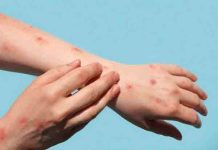 Monkeypox पर केंद्र ने जारी की गाइडलाइंस, ये हैं लक्षण, पंजाब के इस शहर में मिला मंकीपॉक्स का मरीज़, हड़कंप centre