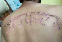 पंजाब की इस जेल में बंद अपराधी की पीठ पर लोहे की गर्म राड से लिखा Gangster wrote