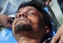 जालंधर के इस एरिया में गुंडागर्दी का नंगा नाच, युवक को बेरहमी से काटा, चली गोलियां