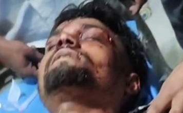 जालंधर के इस एरिया में गुंडागर्दी का नंगा नाच, युवक को बेरहमी से काटा, चली गोलियां